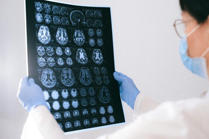 pexels-photo-4226219 a doctor holding an mri result of the brain